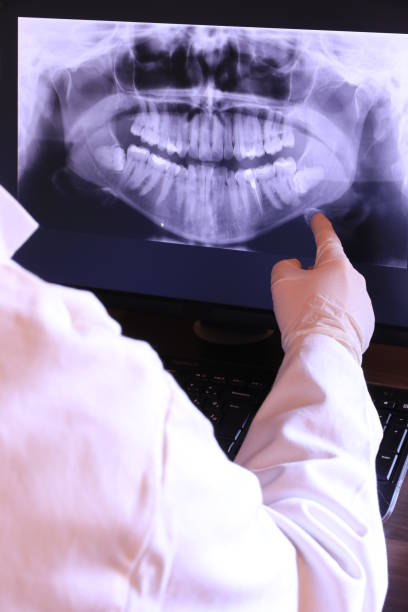 Best Emergency Treatment for Dental Infections or Abscesses in Pittsboro, NC